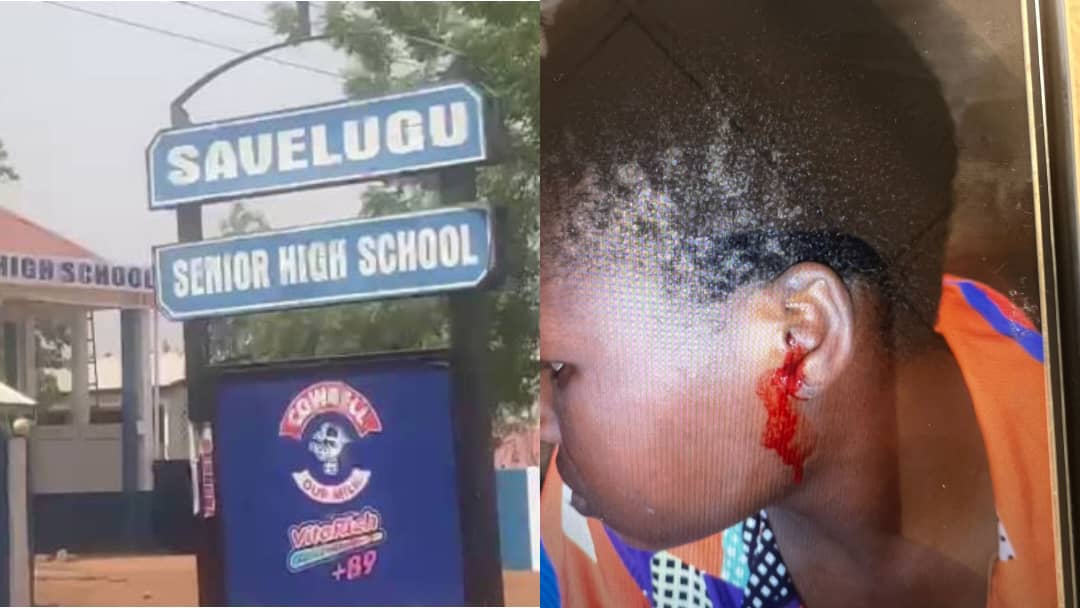 Savelugu SHS assault :  headteacher allegedly destroys student’s ear with slaps